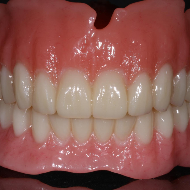 Custom Dental Technologies